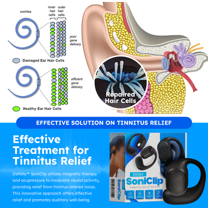 DAFEILA™ SoniClip Tinnitus Relief Device💥