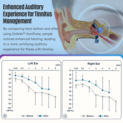 DAFEILA™ SoniPulse Tinnitus Relief Soothing Aid✨