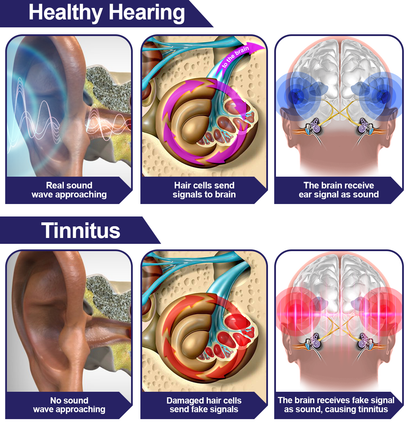 DAFEILA™ INFRAPEACE -Red Light Therapy Ear Plugs🦻